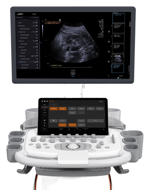 Siemens Healthineers ACUSON Sequoia ultrasound system