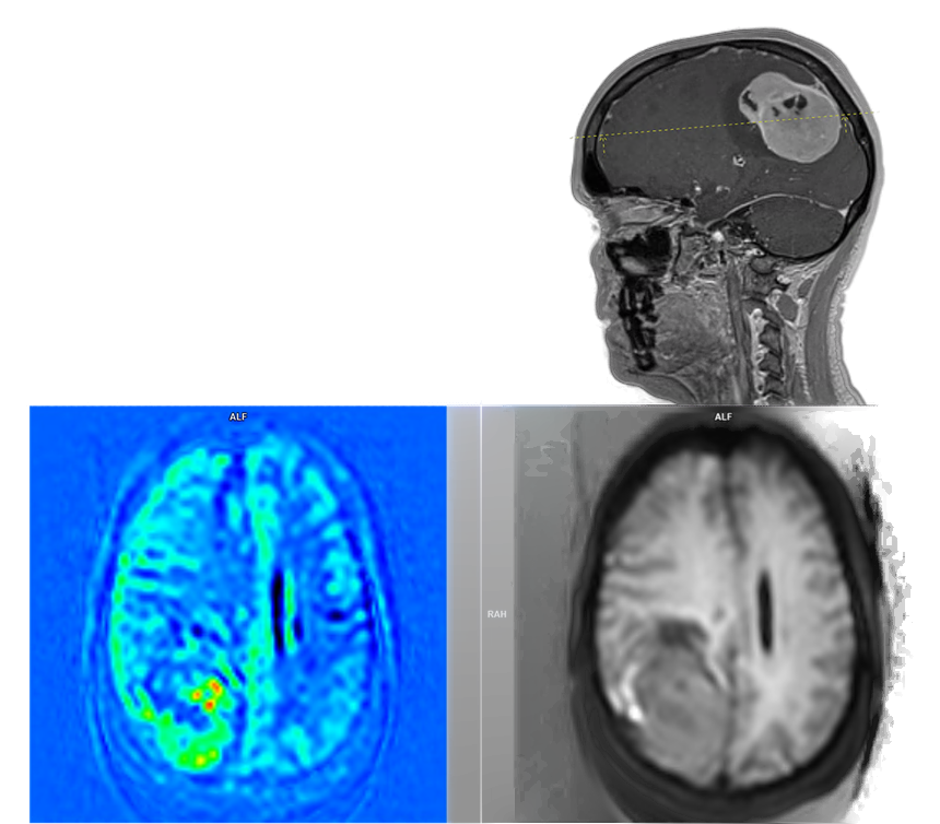 Siemens Healthineers syngo.via imaging software interface